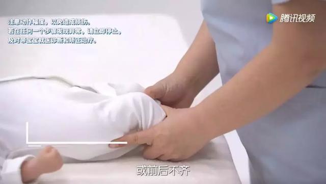 注意！宝宝腿纹臀纹不对称，可不能忽略！