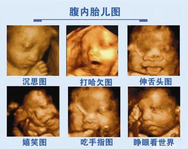是不是“熊孩子”就看孕妈的生活习惯