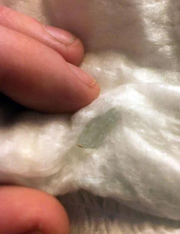 女儿换上尿布却哭痛，妈妈打开发现尿布里竟有一块碎玻璃