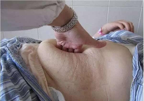 为啥生完孩子，女人老10岁？5个损伤重灾是关键