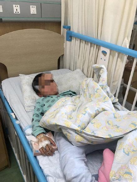 男孩坐取暖器上腿部被烧伤，妈妈怕其感冒只用冷水冲了一下，结果需要植皮