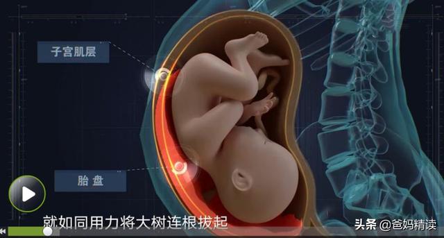 我生孩子赔了命，老公说：这是你自己选的