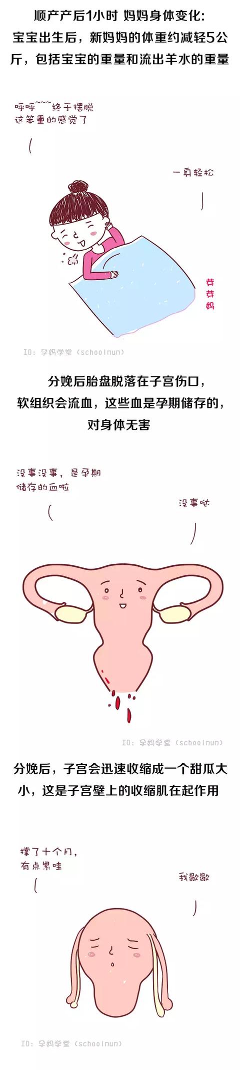 产后24小时详细注意事项—顺产、剖腹产都能用得上！