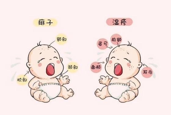 湿疹和热疹的区别 妈妈你别再傻傻分不清了
