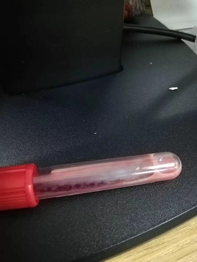 医生惊了！怀胎32周孕妇突发腹疼，抽血检查发现有半管都是油脂……