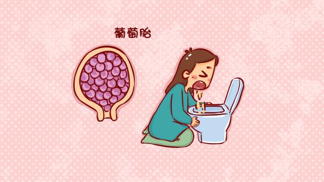 这3种原因会导致孕早期出血，最严重的是第一个