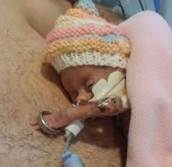 生命斗士！出生体重不到1斤，手能穿过戒指，英迷你婴儿长大了！