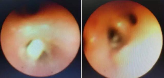 宝宝“肺炎”拖了2个月，医生找出原因后，家长“蒙圈”了！