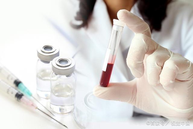 孕期，为什么要做唐筛？关于唐筛的这3个问题，孕妈要提前了解！