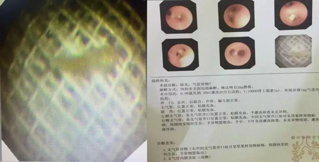 宝宝“肺炎”拖了2个月，医生找出原因后，家长“蒙圈”了！