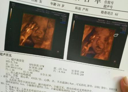 怀孕7个月是胎儿发育高峰期，4个关键指标不容忽视，孕妈要注意