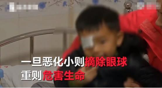 2岁男童右眼似猫眼反光，父母长期疏忽导致眼球被摘除