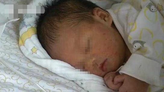 女子诞下男婴，几小时后孩子身上长满“脓包”，只因奶奶此种举动