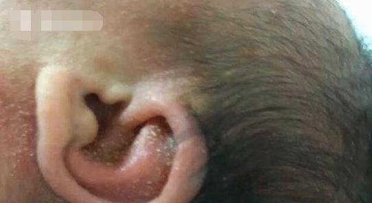 女子诞下男婴，几小时后孩子身上长满“脓包”，只因奶奶此种举动