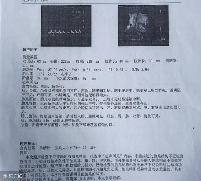孕期羊水多少是正常？产检报告上这个指数告诉你答案