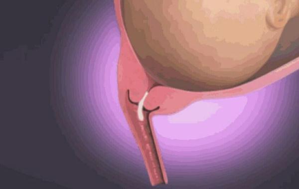 顺产到底有多疼？8张图片告诉你女人有多不容易