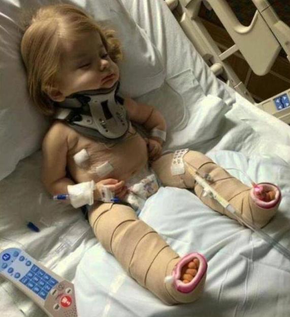 宝宝出生前被诊断骨不全，母亲坚持生下引来一片质疑