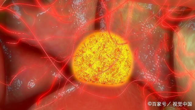 卵泡发育不良时，身体可能会发出这3个信号，对照一下你有吗？