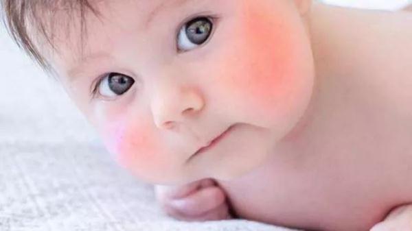 爸妈必看！孩子“苹果脸”的2个不良信号