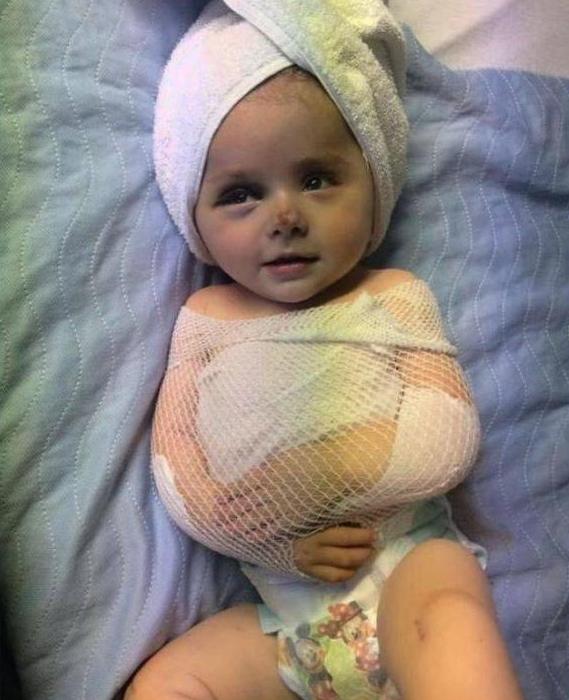 宝宝出生前被诊断骨不全，母亲坚持生下引来一片质疑