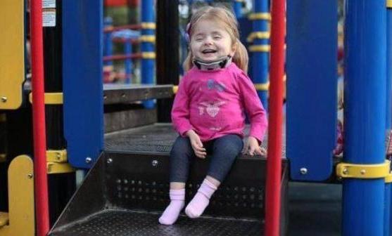 宝宝出生前被诊断骨不全，母亲坚持生下引来一片质疑