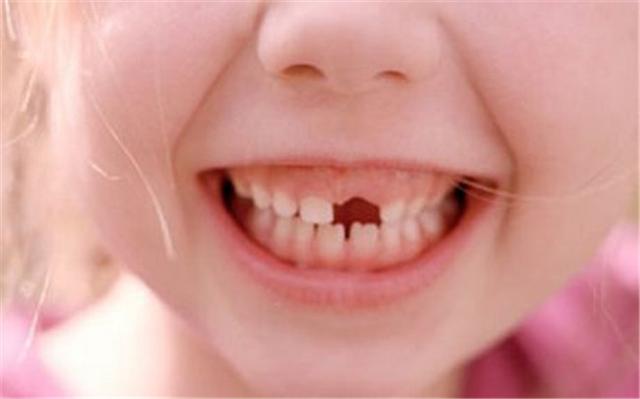 格格：宝宝换下来的乳牙你都扔了吗？关键时刻可挽救孩子生命