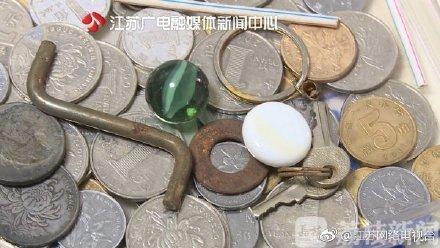 1岁半宝宝吞硬币 18天后取出来变成这样……