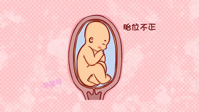 孕期胎位不正怎么办？这两个纠正胎位动作很管用，准妈在家就能做