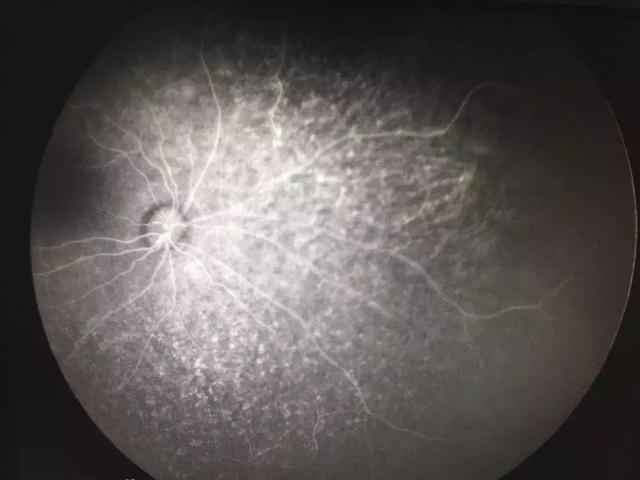 孩子出生“见不得光”，3年后，父母在河南省儿童医院找到了答案