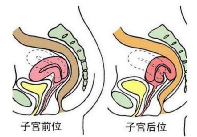 若女人不易受孕，身体可能有这3种情况，不妨对照自查一下！