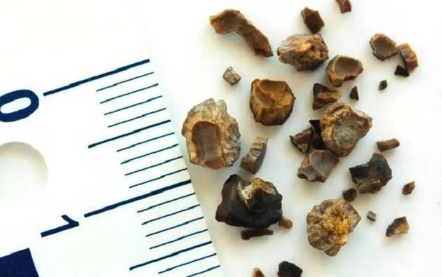 婆婆居然这样带娃?人民日报总结的44个错误育儿法,对照自查!