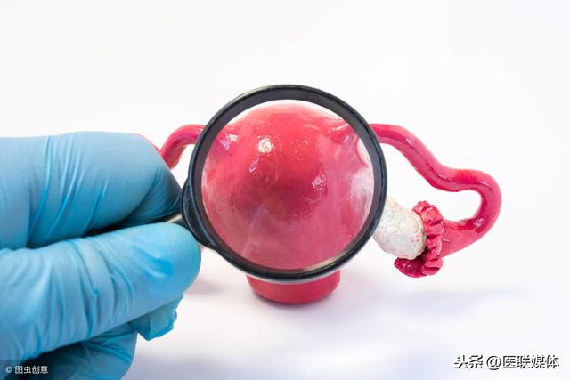 女人子宫有异常，身体会“流露”4个表现，一眼能看出来