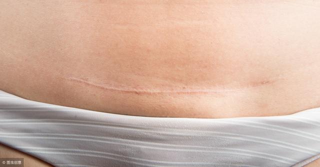 剖腹产后不到2年，再次怀孕危险吗？这些妈妈的经历给你一些参考