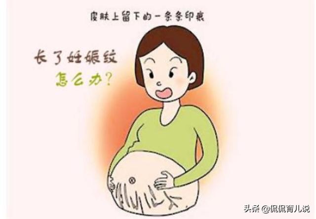 孕期长妊娠纹的原因就一个？中了千万别气馁，接受现实吧宝贝！