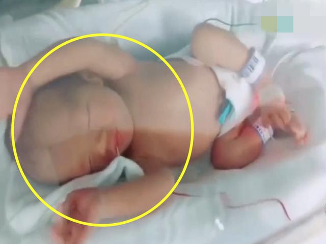新生儿在保温箱里,双手抱紧自己的样子好可爱,网友:萌翻天了