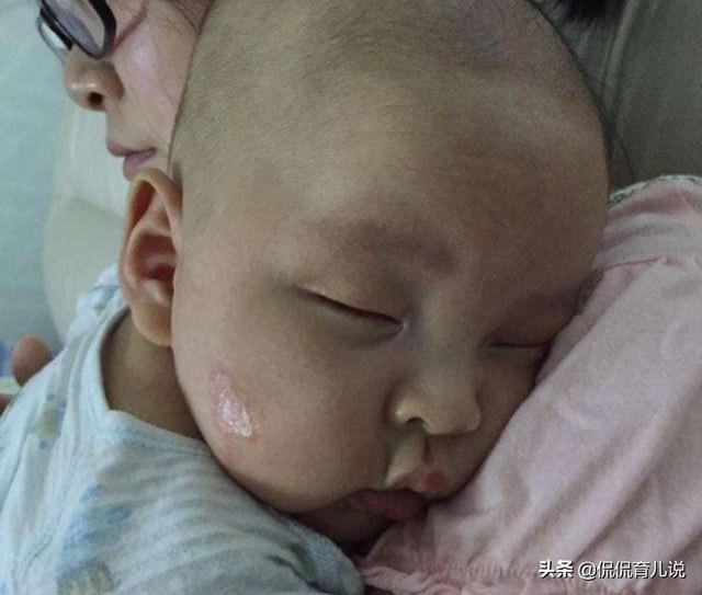 新生儿出生两天后身上长满脓包？原来是因为老人做错了这个！