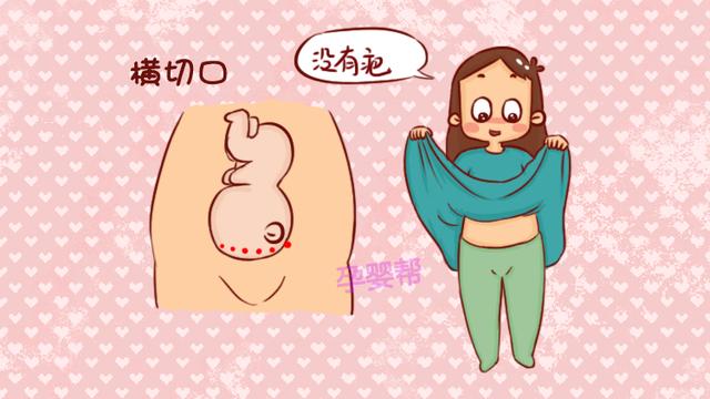 剖腹产“横切”和“竖切”有啥区别？产科医生：差异二胎会很明显