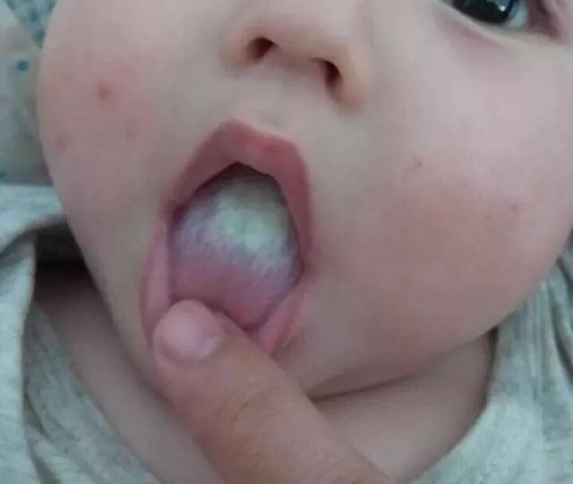 宝宝舌苔又白又厚？原来是这2个原因导致，妈妈恍然大悟
