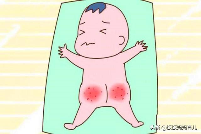 宝宝红屁屁多因这2种原因，5种预防方法2个妙招，值得妈妈学习！