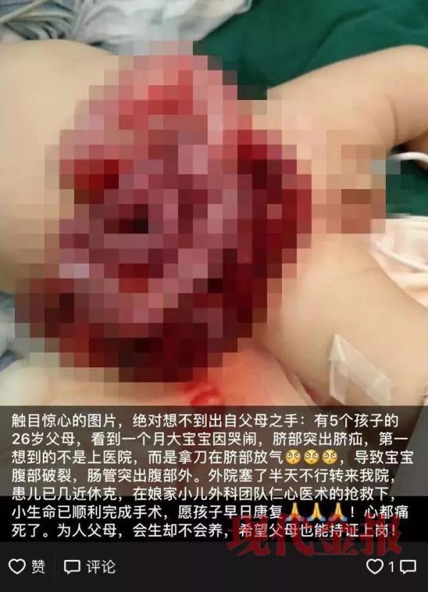 不可思议！男婴肚脐外鼓，爸爸为放气竟拿起刀片划一下