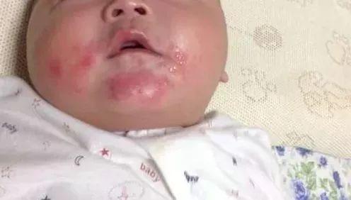 你还在这样给孩子擦口水？只会越擦越糟……