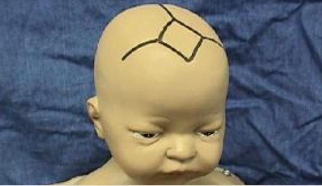 若宝宝囟门出现这情况,宝妈别忽视可能是智商问题,有科学依据的