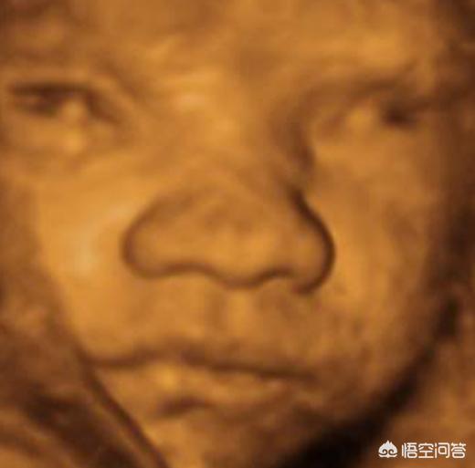 听说以前小孩子生下好几天才睁开眼，现在生下来就能睁开眼，为什么？