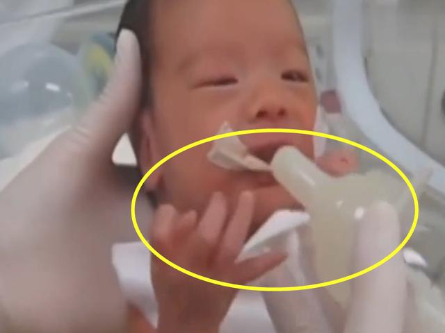 护士喂早产儿喝奶，接下来宝宝可爱的小模样，要萌翻天了