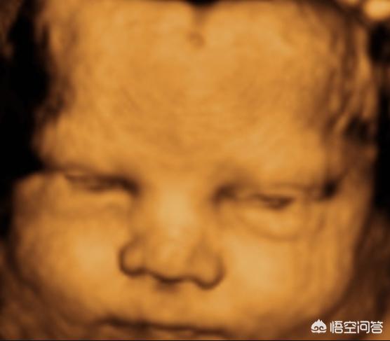 听说以前小孩子生下好几天才睁开眼，现在生下来就能睁开眼，为什么？