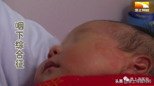 宝宝出生仅1天，竟患上咽下综合征，减少吐奶有妙方！点开看看吧