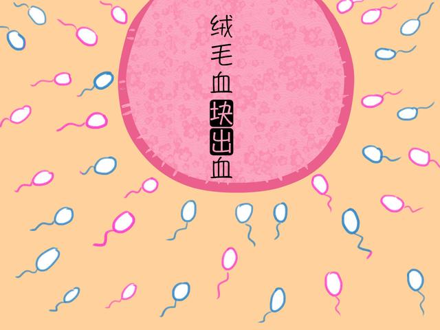 怀孕后“月事”上门？除了流产，还有这几种可能性，别慌张！