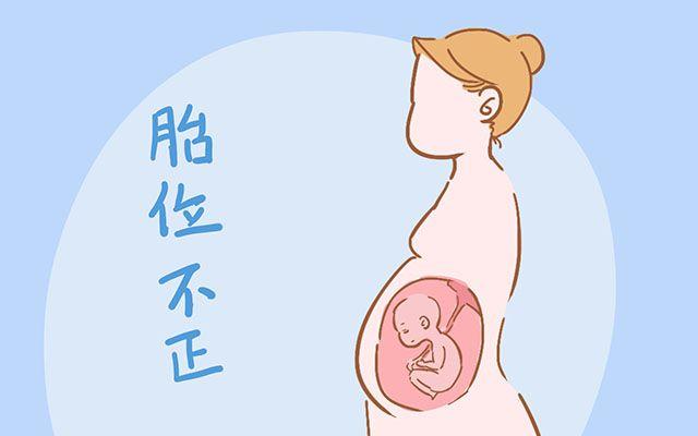 大家都说顺产好，但剖腹产这4点好处顺产比不上