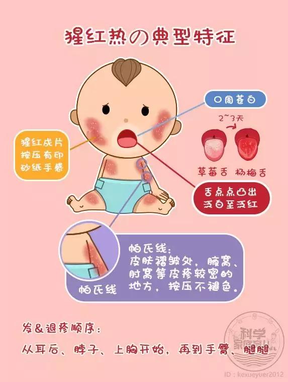不是所有发烧出疹都是幼儿急疹！这种情况必须尽快就医、隔离！