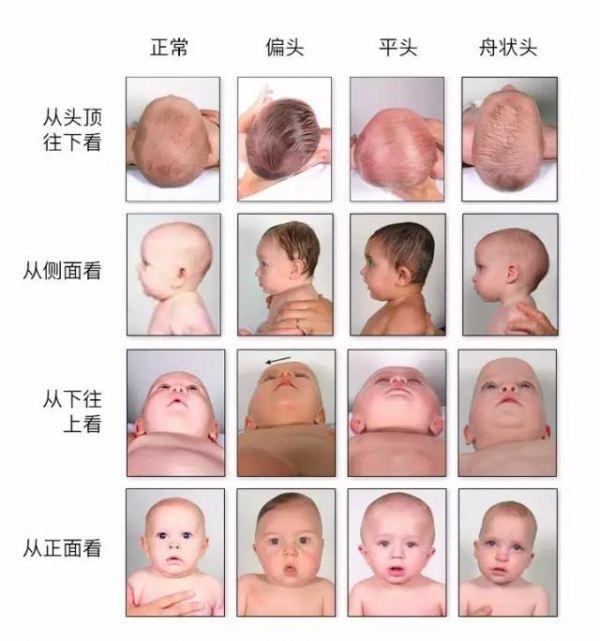 除了捏鼻梁，这几种提升颜值的方法，也是奶奶们的最爱